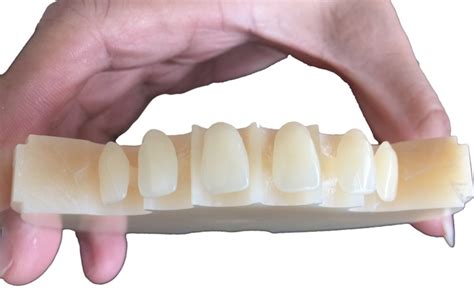 what does pmma stand for in dental
